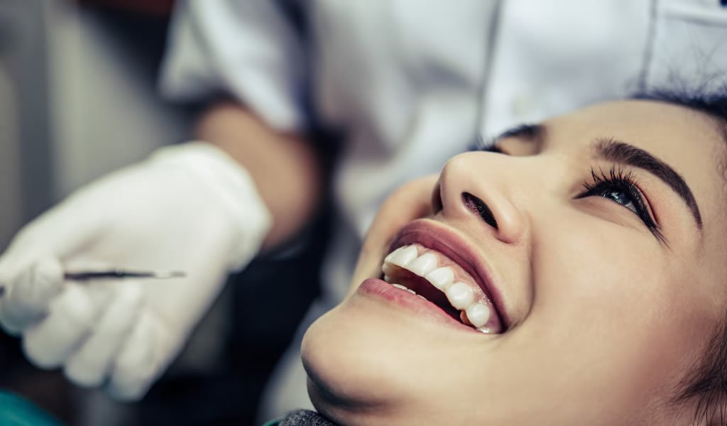 Las ventajas de las carillas dentales